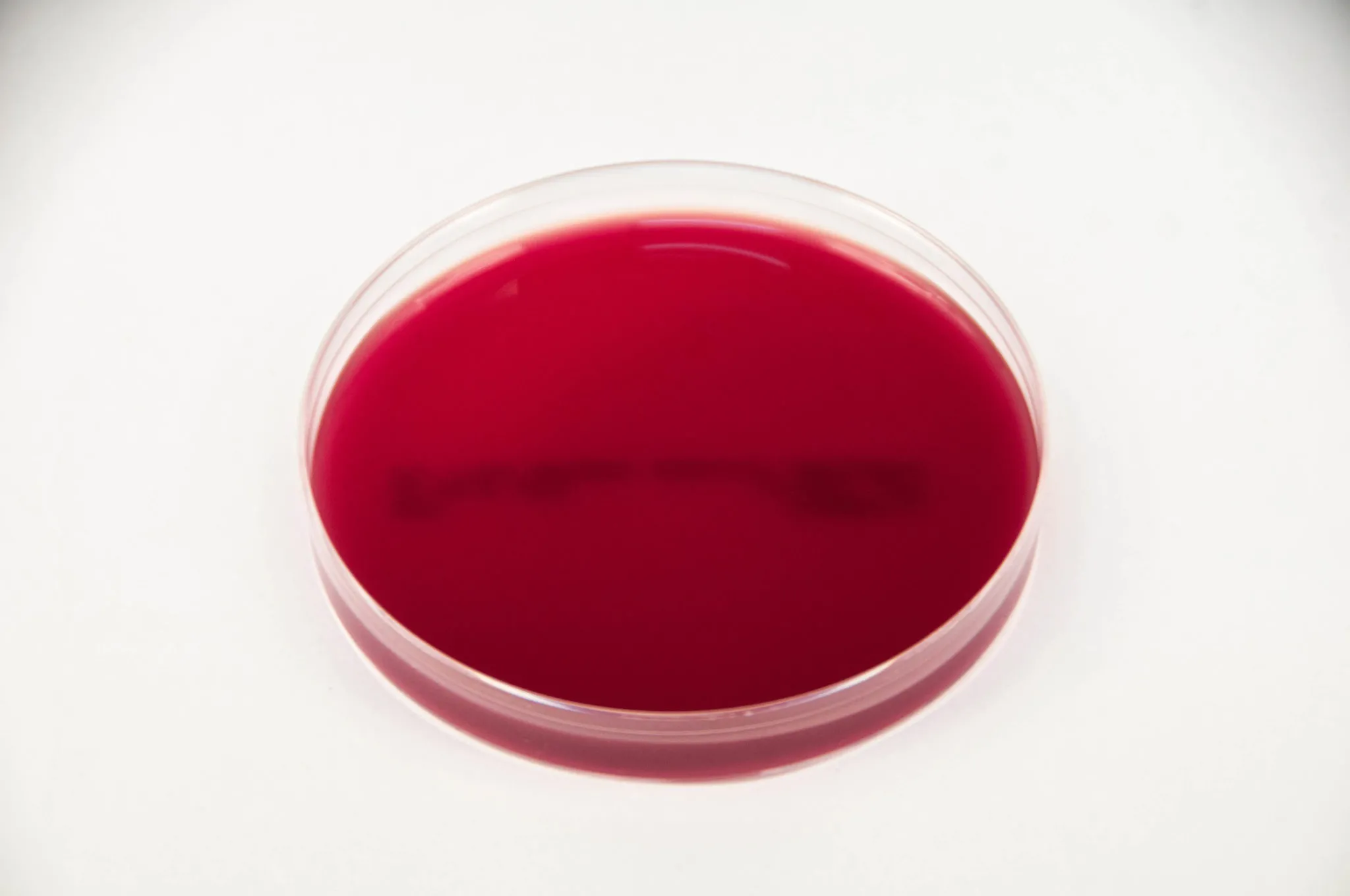 Trypticasein Soy Blood Agar Base