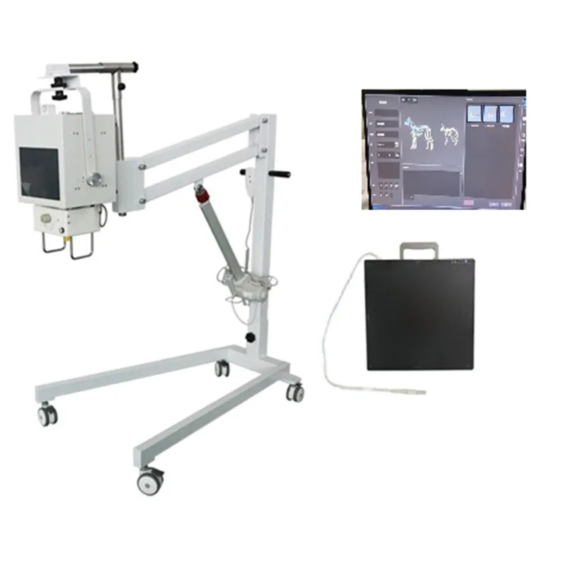 Mobile Digital Radiography X-ray System VC-NKX-100D